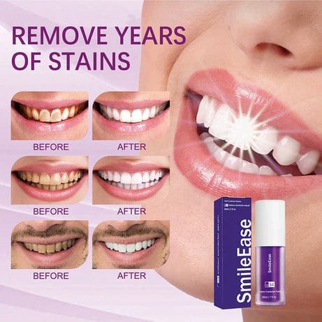 Hismile V34 Purple Teeth Whitening Serum